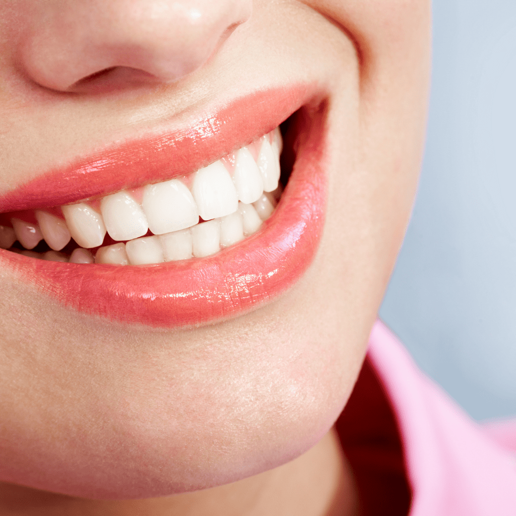 Clareamento odontológico Branqueamento dental | Dentes brancos Como clarear os dentes Tratamento de clareamento dental | Clareamento caseiro | Clareamento a laser Clareamento com moldeira Clareamento dental antes e depois